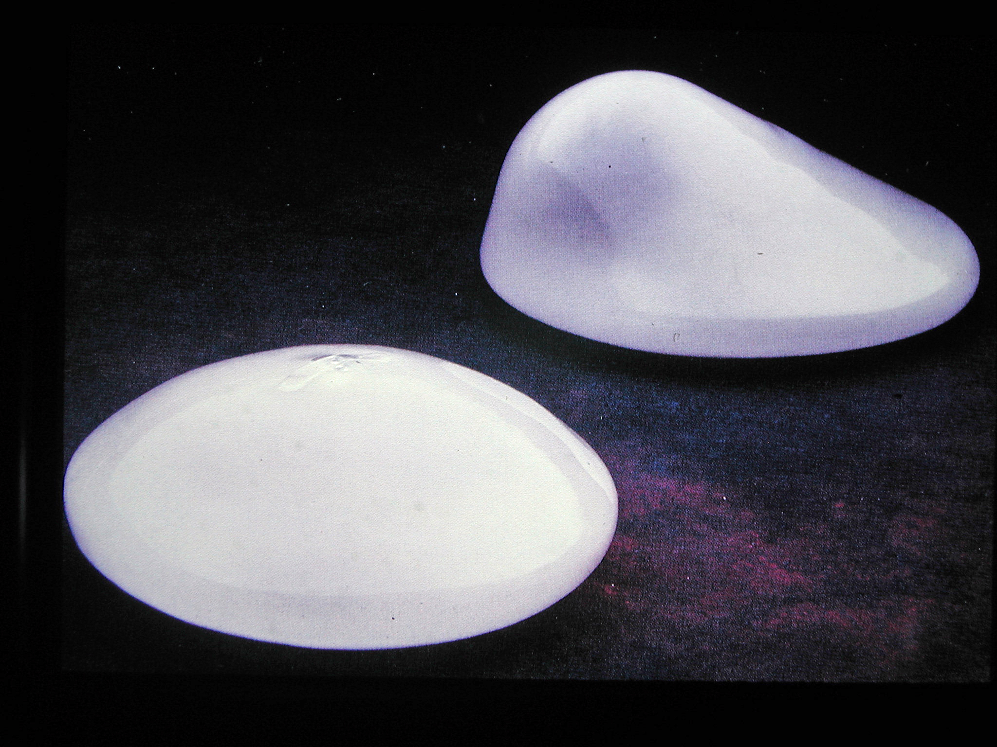 Breast Implants Silicone 78