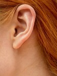ear-plastic-surgery-indianapolis-dr-barry-eppley