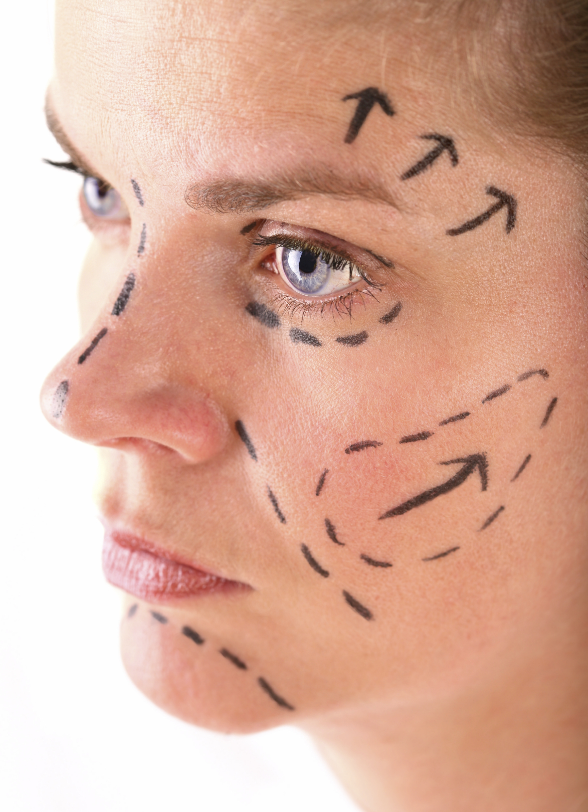 Facial Cosmetic Surgery Procedures 42
