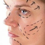 facial-implants-indianapolis-dr-barry-eppley