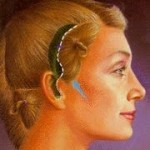 life-style-lift-limited-facelift-indianapolis-dr-barry-eppley1