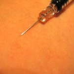 lipodissolve-injection-treatments-indianapolis-dr-barry-eppley