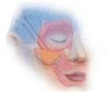 midface-lift-surgery-dr-barry-eppley-indianapolis