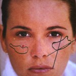 cheek-implant-plastic-surgery-indianapolis-dr-barry-eppley1