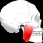 masseter-muscle-jaw-angle-implants-dr-barry-eppley-indianapolis