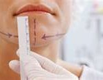 chin-reduction-surgery-dr-barry-eppley-indianapolis