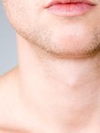 chin-and-jawline-enhancement-dr-barry-eppley-indianapolis