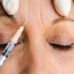 botox-for-glabellar-frown-lines-dr-barry-eppley2