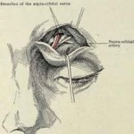 supraorbital-nerve-dr-barry-eppley-indianapolis1