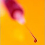 prp-facial-rejuvenation-dr-barry-eppley-indianapolis