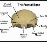 frontal cranioplasty Archives