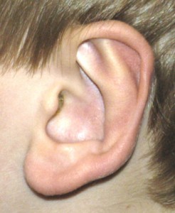 Ear Anatomy Dr Barry Eppley Indianapolis