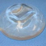 silicone breast implant history dr barry eppley indianapolis