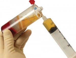 Platelet Rich Plasma PRP Therapy Dr Barry Eppley Indianapolis