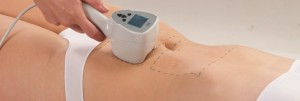 Exilis Skin Tightening Indianapolis Dr Barry Eppley