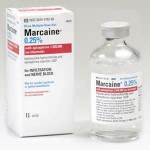 Marcaine Injections in Migraine Surgery Dr Barry Eppey Indianapolis