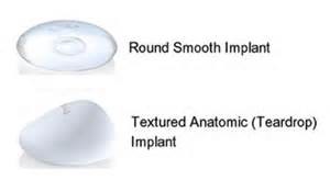 Smooth vs Shaped Breast Implants