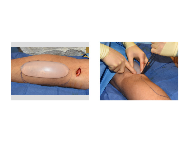 Lower limb questions and answers pdf picture