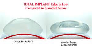 Ideal Implant shape Dr Barry Eppley Indianapolis