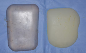 custom-pectoral-implant-vs-standard-pectoral-implant-dr-barry-eppley-indianapolis