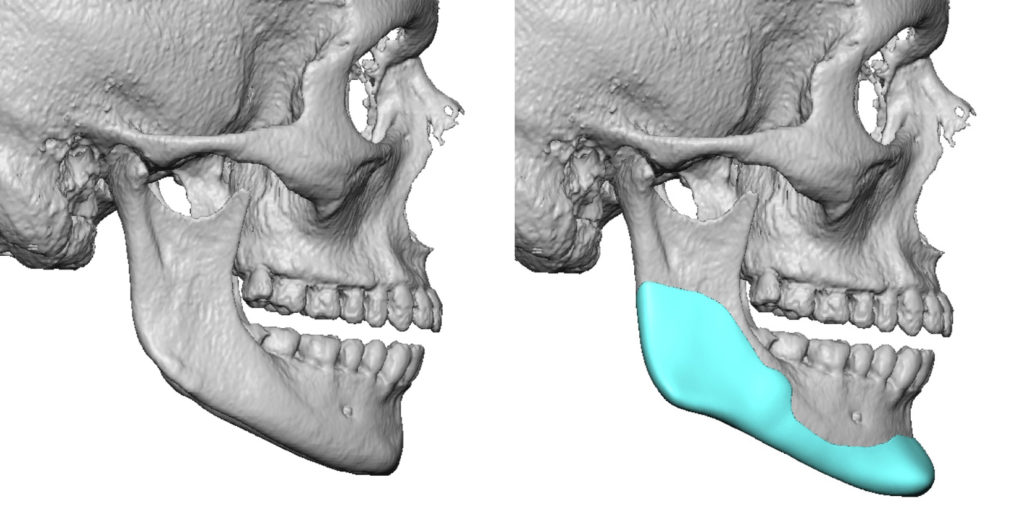 Big skinny case harvard image