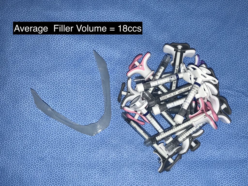 Volumetric Comparisons of Custom Skull and Facial Implants vs ...