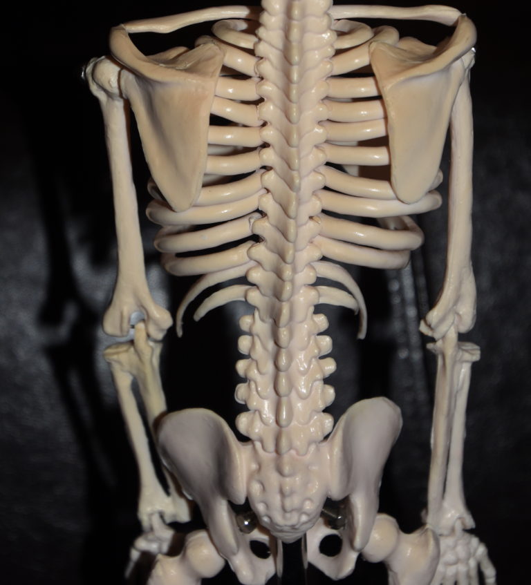 Anatomic Model of Lower Ribcage for Rib Removal Surgery for Waist