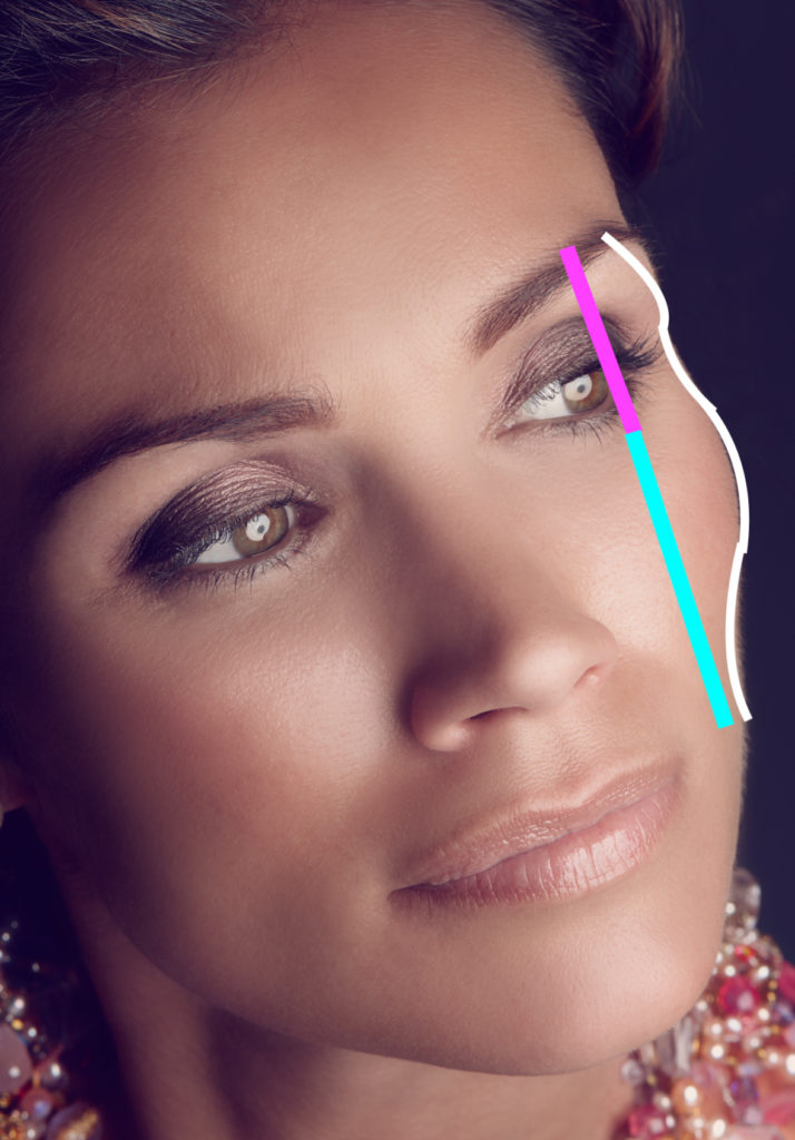 Aesthetic Insights The Ogee Curve and Cheek/Midface Augmentation