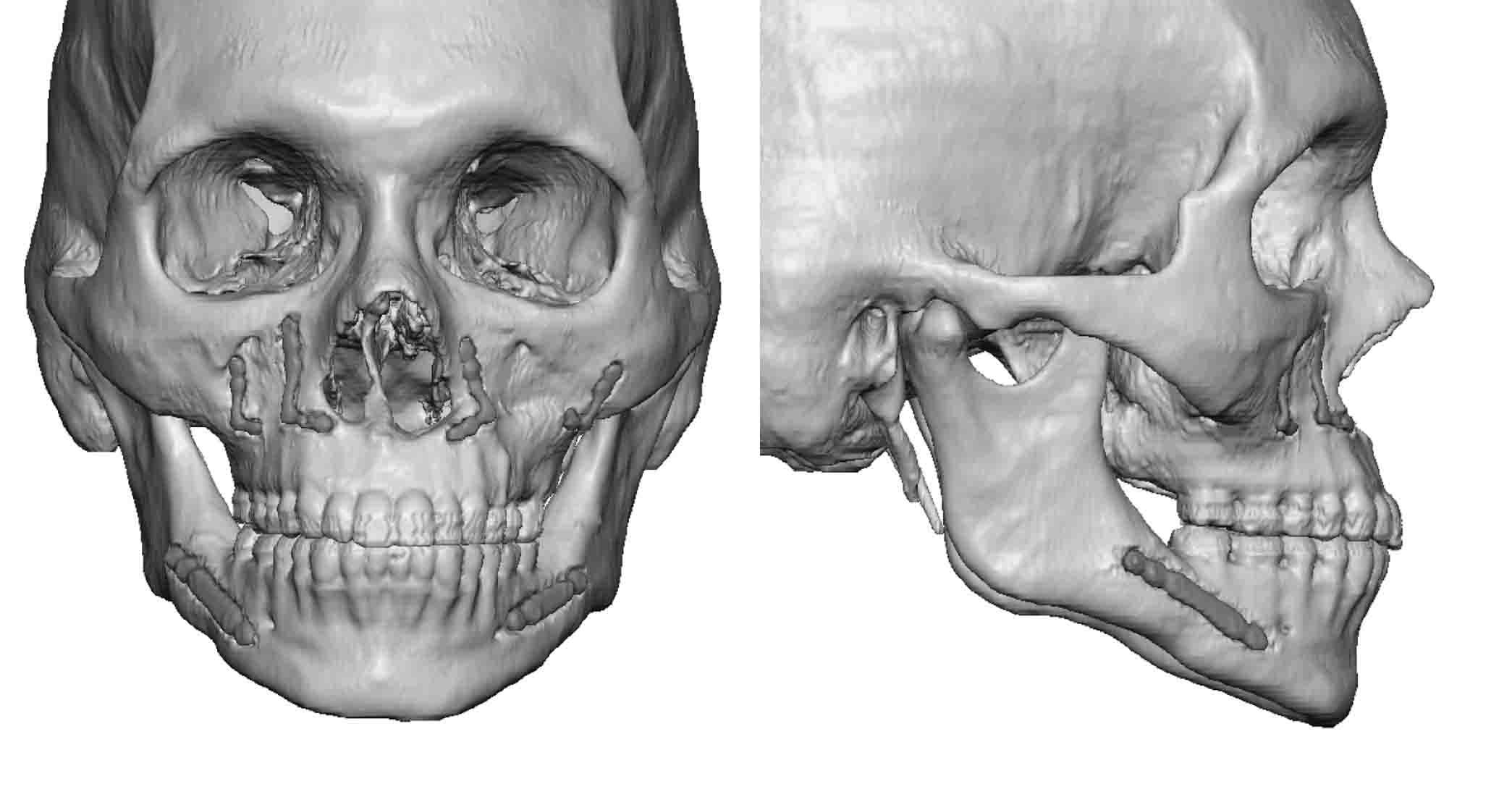 body shape surgery