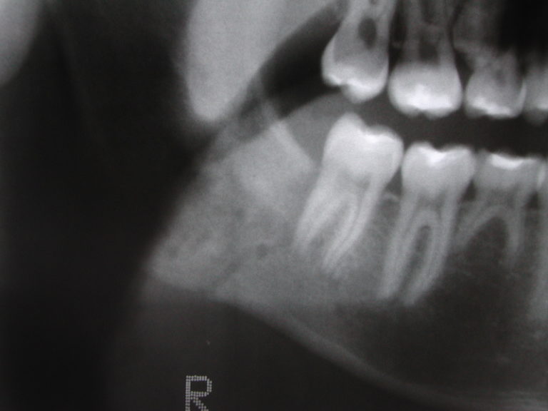 Aircraft maintenance safety videos picture