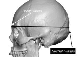 occipital ridge