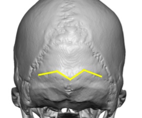 occipital ridge