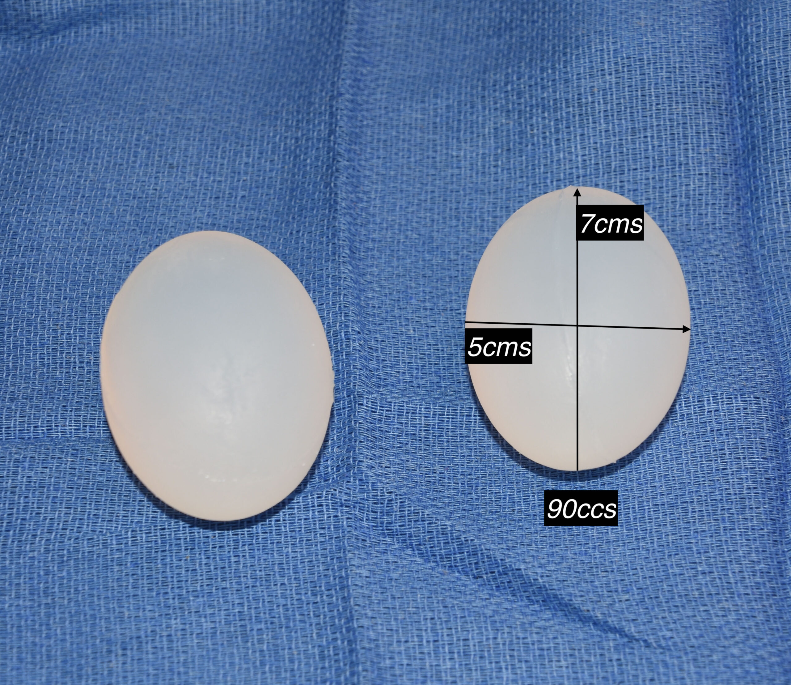 7cm Custom Testicle Implants Dr Barry Eppley Indianapolis Explore Plastic Surgery
