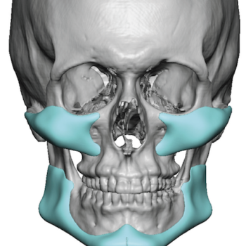 facial masculinization surgery Archives - Explore Plastic Surgery