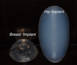 How Are All Other Aesthetic Body Implants Different From Breast Implants? -  Explore Plastic Surgery