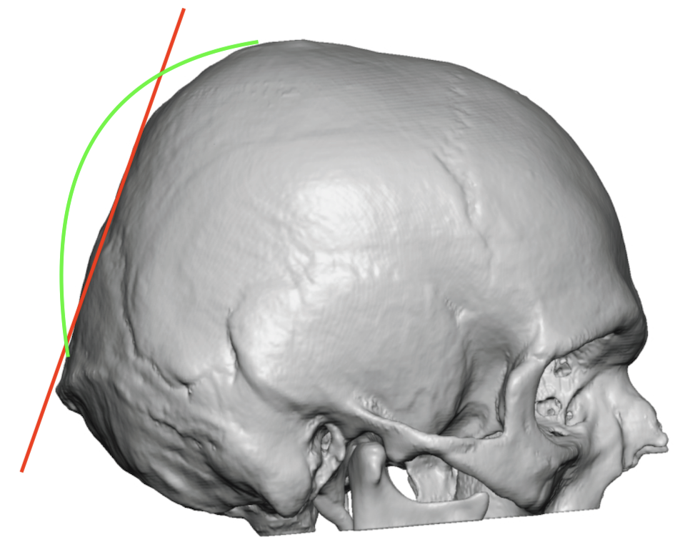 male head side view