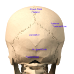 Back of head skull anatomy Dr Barry Eppley Indianapolis - Explore ...