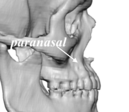 central midface anatomy side view Dr Barry Eppley Indianapolis ...