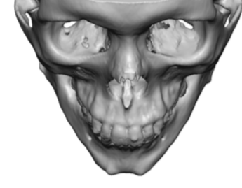 Male vs Female Gender Differences in Lower Jaw Anatomy and Custom ...