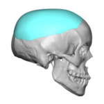 Plastic Surgery Case Study - Adult Scaphocephalic Total Head Reshaping ...