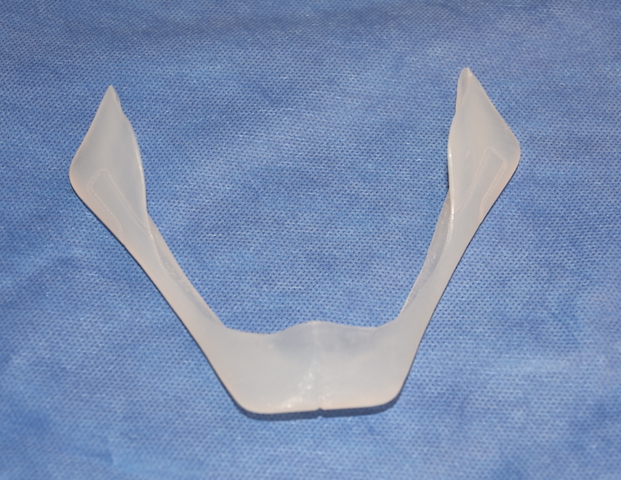 Plastic Surgery Case Study - Large Male Custom Jawline Implant Result ...