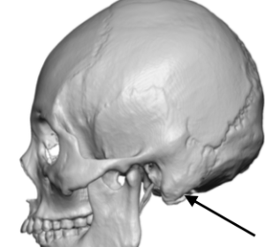 mastoid process palpation