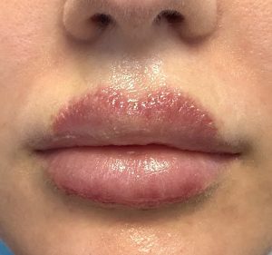 Cupid's Bow: What It Is and What It Looks Like