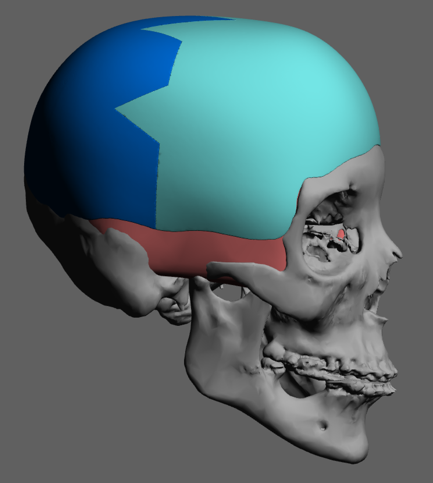 Aesthetic Skull Reshaping