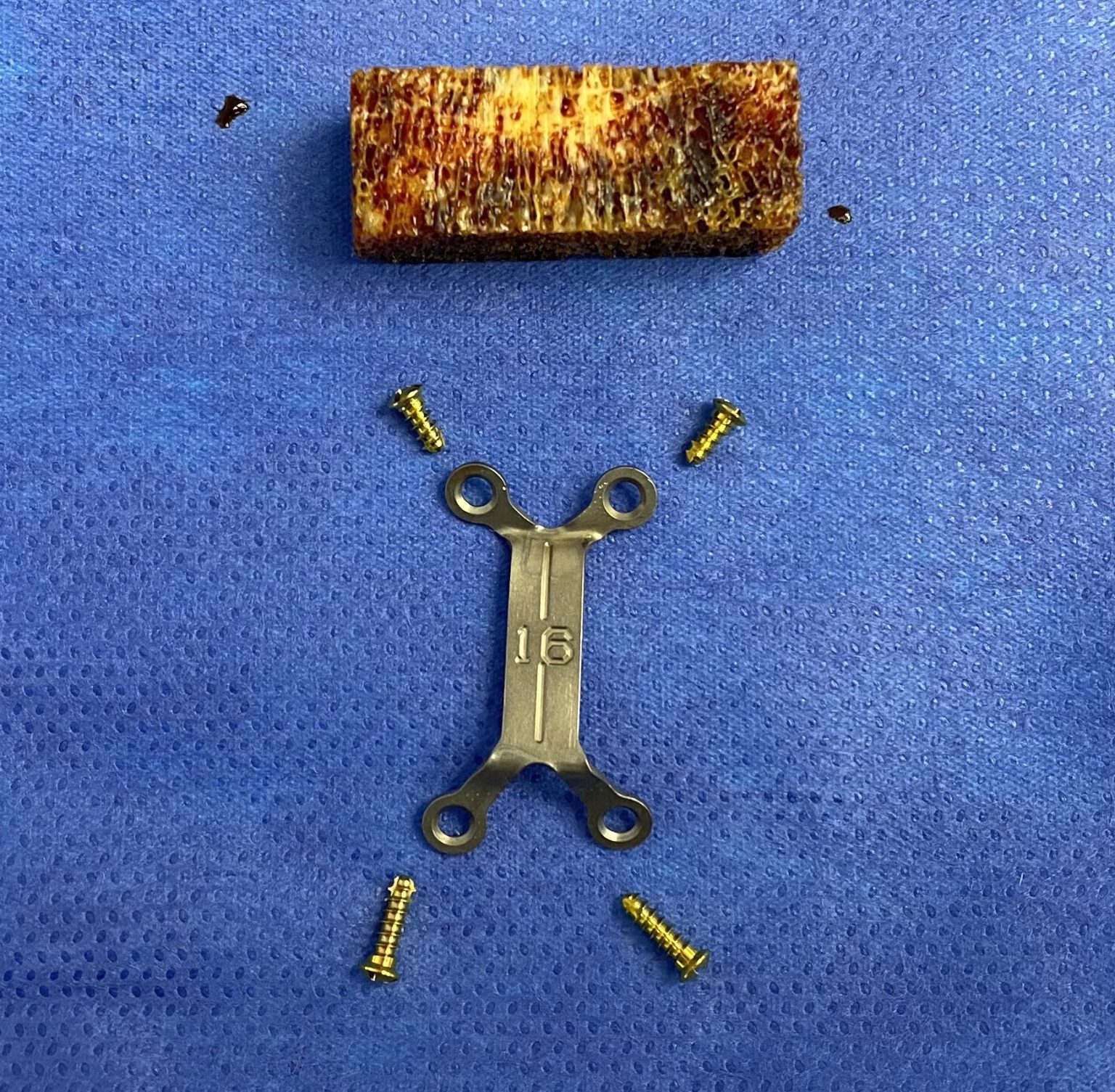 Technical Strategies Allogeneic Bone Grafting in Vertical Chin