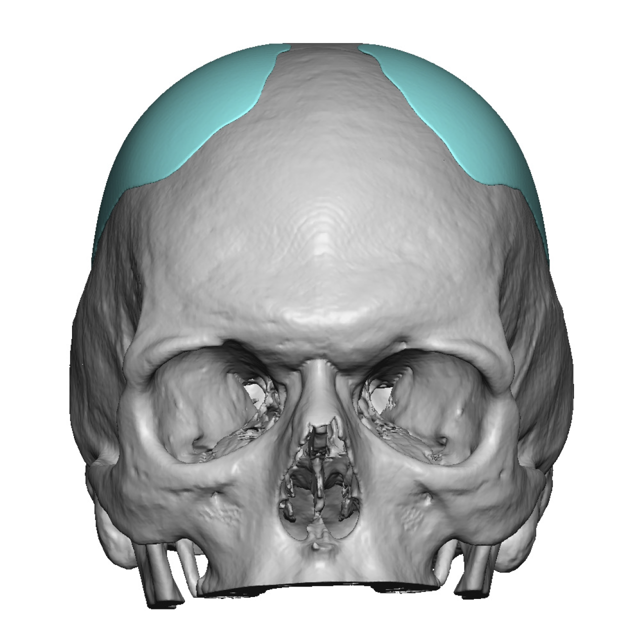 Plastic Surgery Case Study - Five Year Long Term Correction of the ...