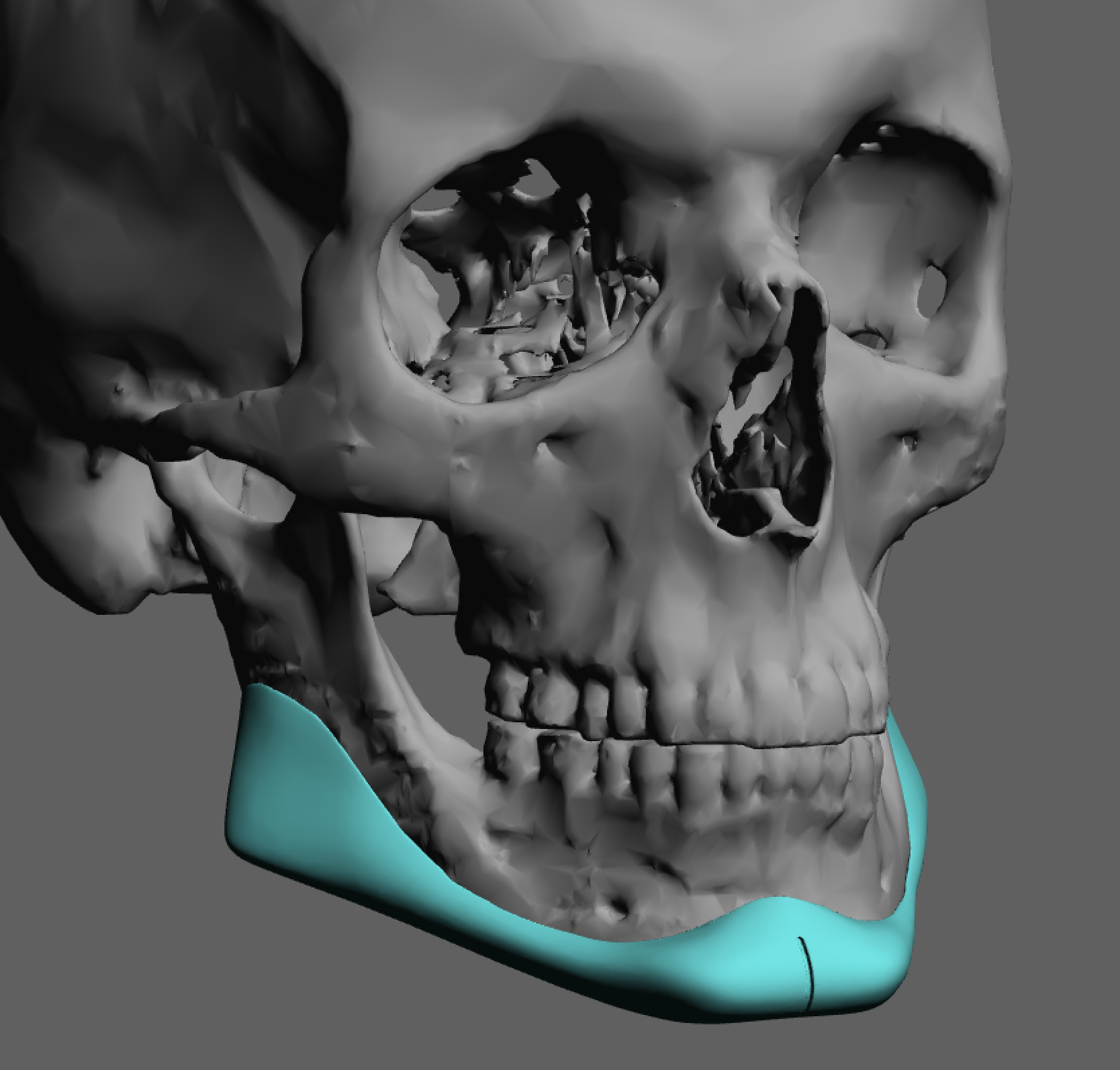 Plastic Surgery Case Study - The Different Effects of Standard vs ...