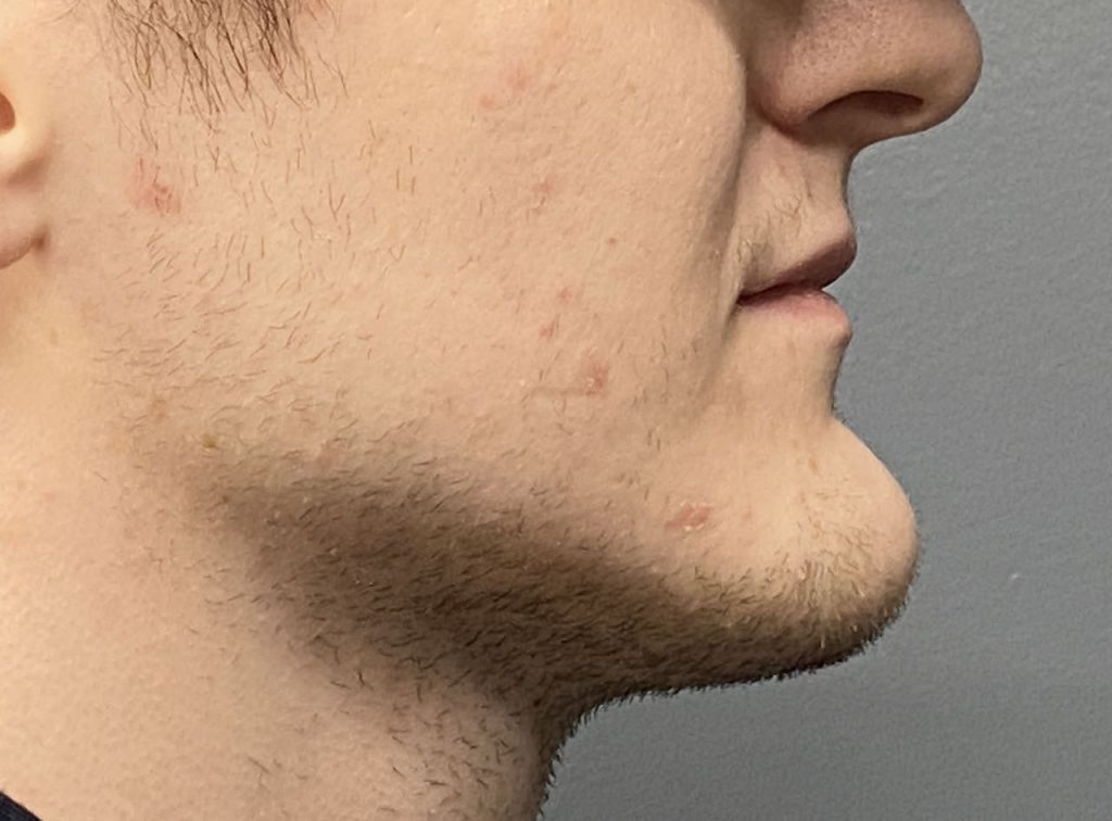 Plastic Surgery Case Study Reduction Of The Large Horizontal plastic-surgery-case-study-reduction-of-the-large-horizontal