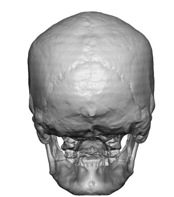 9-muscles-of-the-head-musculoskeletal-key