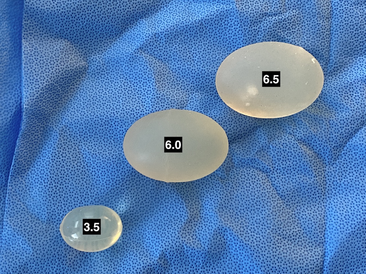 technical-strategies-implant-sizing-in-the-side-by-side-displacement